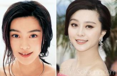 娱乐圈整容失败案例,美丽陷阱与代价